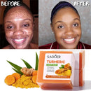 Organic Turmeric + Kojic acid Soap Face Cleansing & Whitening